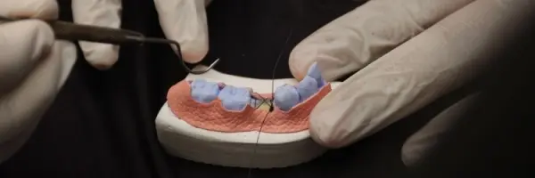ATRAUMATIC EXTRACTION AND RIDGE PRESERVATION