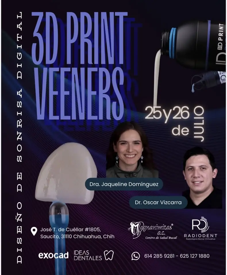 3D PRINT VEENERS