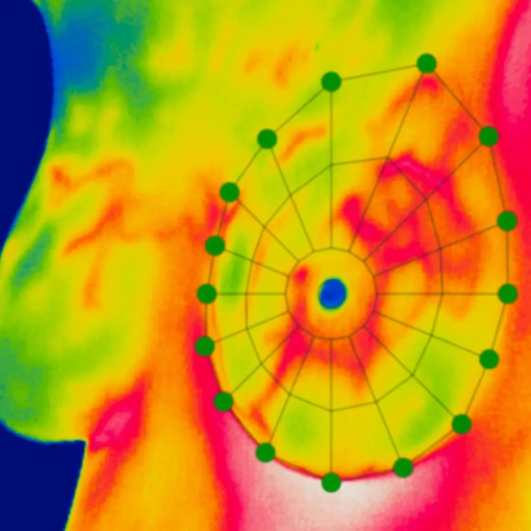 A New Approach to Breast Health: Turning Fear Into Power