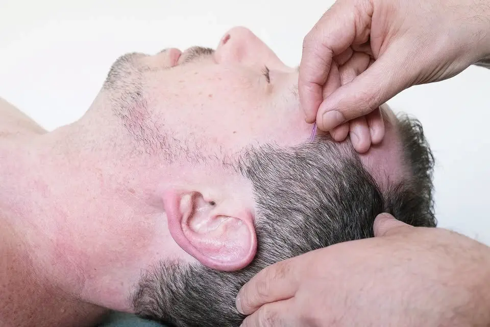 Medical Acupuncture - Level 1 - September London