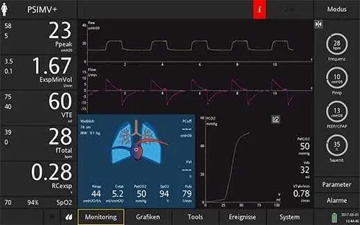 Lung POCUS Pediatric Acute Care 