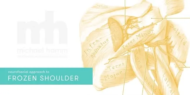 Neurofascial Approach to Frozen Shoulder